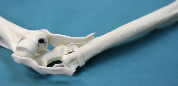 Artroplastika komolčnega sklepa pri psih